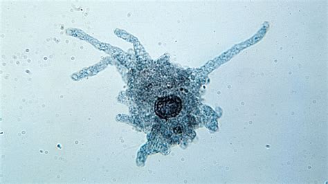  Iserum: An Amoeba That Thrives on Microscopic Meals!