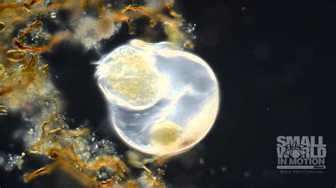  Thécamoeba!  Discover This Intriguing Single-Celled Organism That Crawls and Engulfs Its Prey