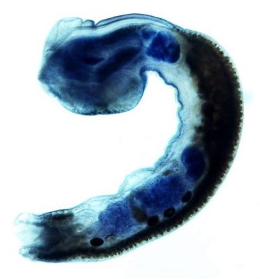  Yoshimasu - Trematode Parasite That Lurks in the Depths of Aquatic Environments