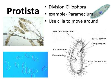  Zoomastigophora: This Tiny Creature Moves Like a Whipping Dancer, But Don't Expect Any Fancy Footwork!